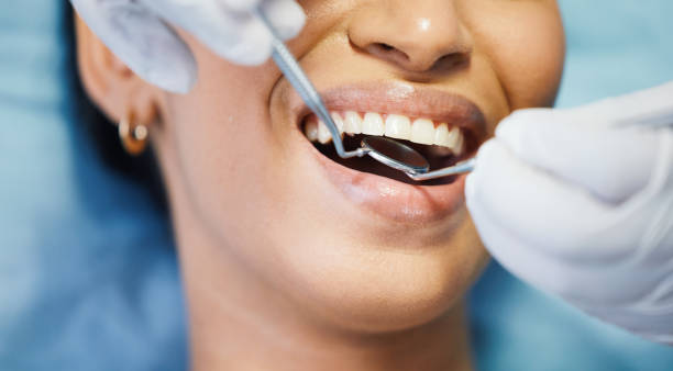 Best Tooth Pain Emergency Relief  in Sharon Center, OH